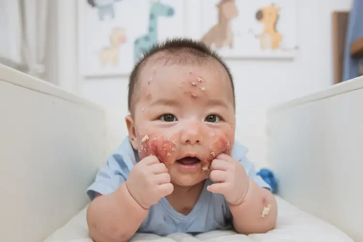 寶寶臉上起濕疹不管它會自己自愈嗎(圖4)