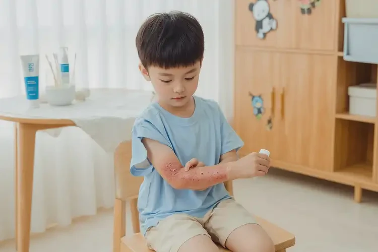 孩子大腿经常长湿疹可不可以彻底自愈(图2)