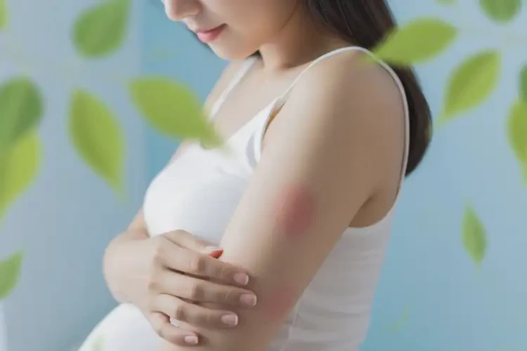 产妇全身出现湿疹能够彻底治愈吗(图3)