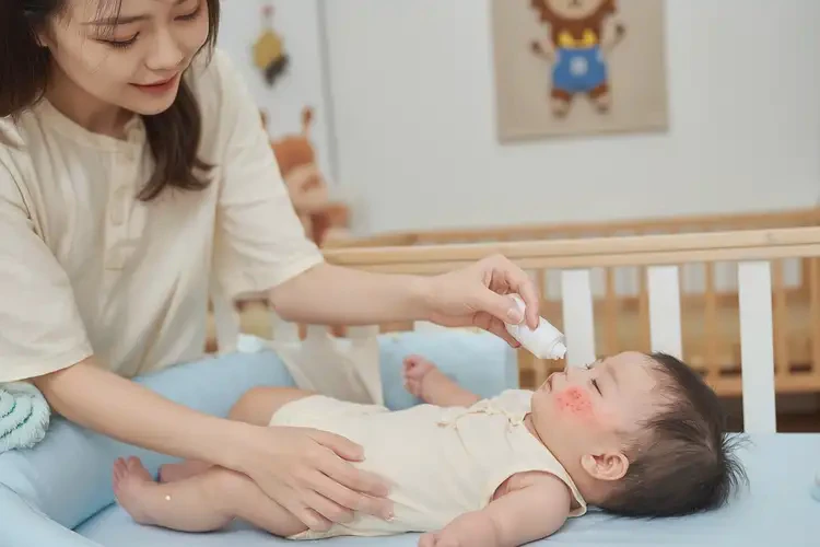 寶寶身上容易起濕疹能靠自己自愈嗎(圖3)