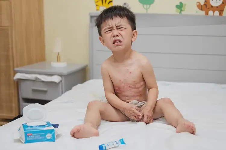 小孩肛周經(jīng)常長濕疹能夠徹底治愈嗎(圖4)