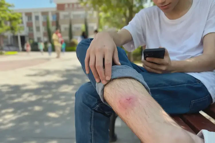 大學(xué)生小腿偶爾長(zhǎng)濕疹不管它會(huì)自己自愈嗎(圖3)