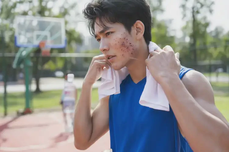 大學(xué)生脖子容易長(zhǎng)濕疹不管它會(huì)自己痊愈嗎(圖1)