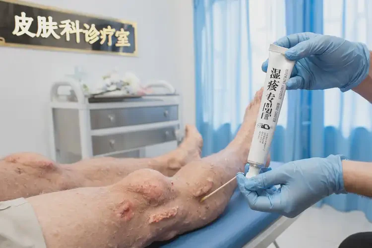 老人四肢出濕疹不管它會自己好嗎(圖2)