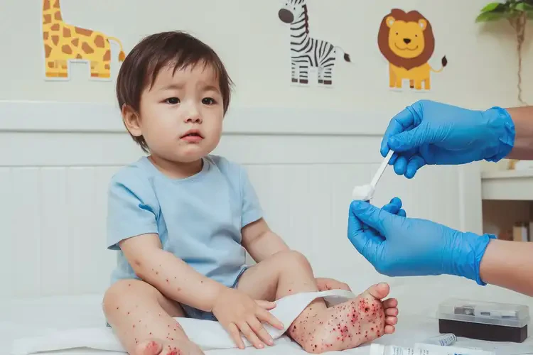 幼兒小腿偶爾起濕疹能徹底自愈嗎(圖3)