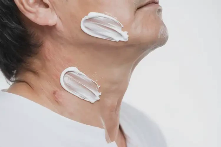 男性脖子偶爾起濕疹不管它會自己自愈嗎(圖3)