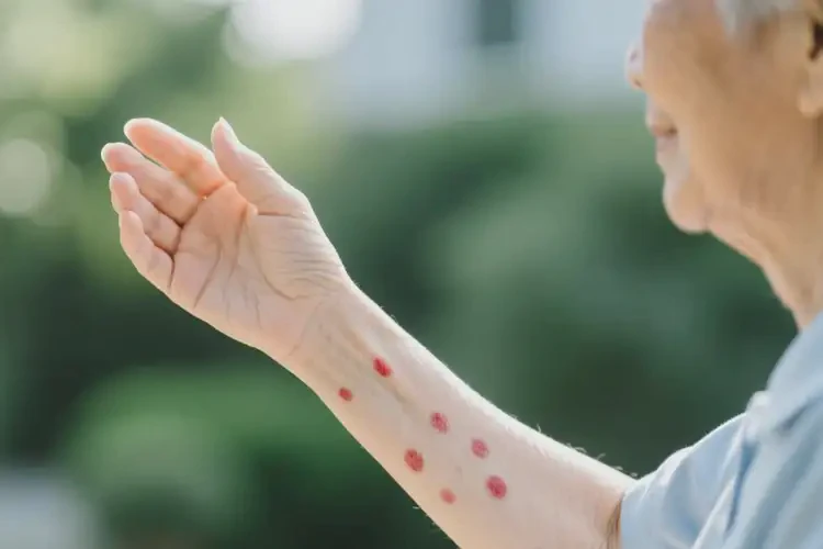老人手臂偶爾起濕疹不管它會(huì)自己自愈嗎(圖2)