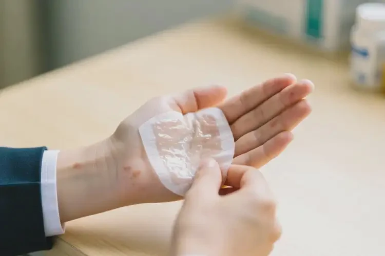 大學(xué)生手上經(jīng)常起濕疹不管它會自己好嗎(圖2)