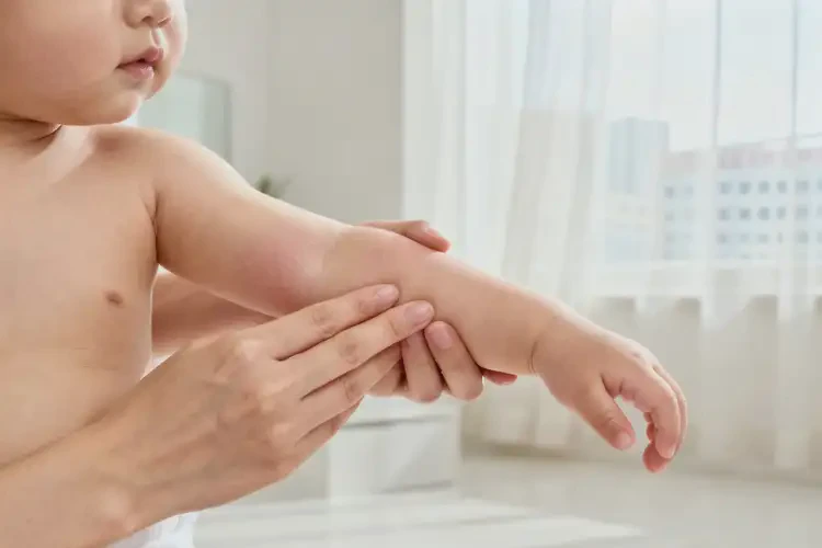 嬰幼兒身上長(zhǎng)濕疹能夠徹底治愈嗎(圖4)