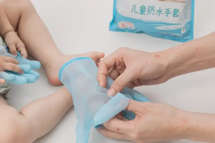 小兒手上經常長濕疹能靠自己自愈嗎(圖1)