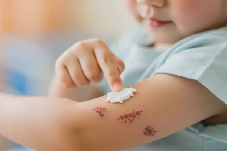 孩子手臂上經常起濕疹能靠自己自愈嗎(圖1)