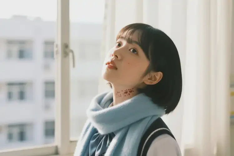 中學(xué)生脖子上經(jīng)常長濕疹不管它會自己痊愈嗎(圖2)