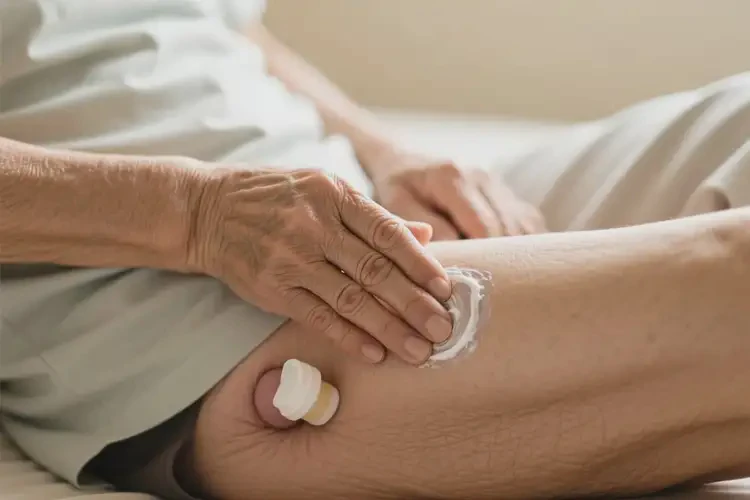 高齡老人肛周經(jīng)常長(zhǎng)濕疹能夠徹底治愈嗎(圖3)