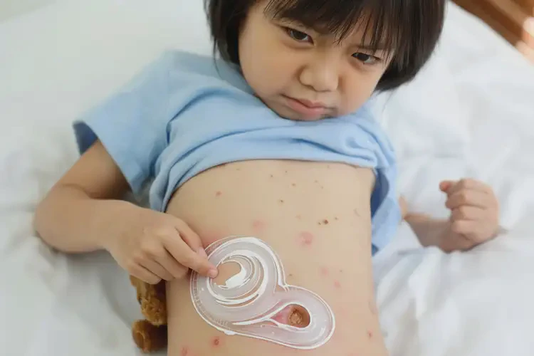 孩子肚子上容易長濕疹能靠自己自愈嗎(圖2)