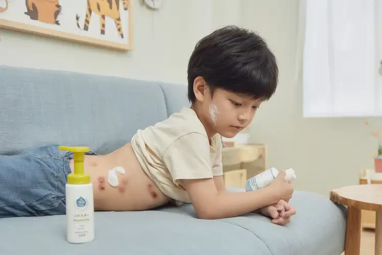少兒肚子上出濕疹不管它會(huì)自己好嗎(圖3)
