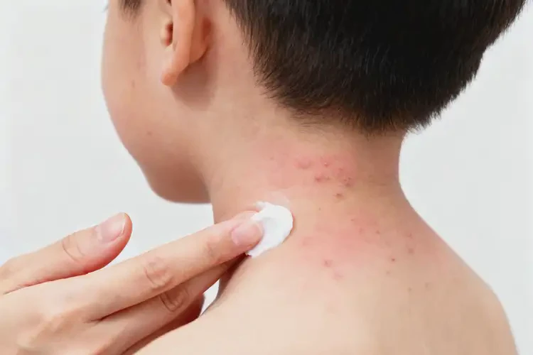 兒童脖子上出現(xiàn)濕疹可以徹底自愈嗎(圖1)