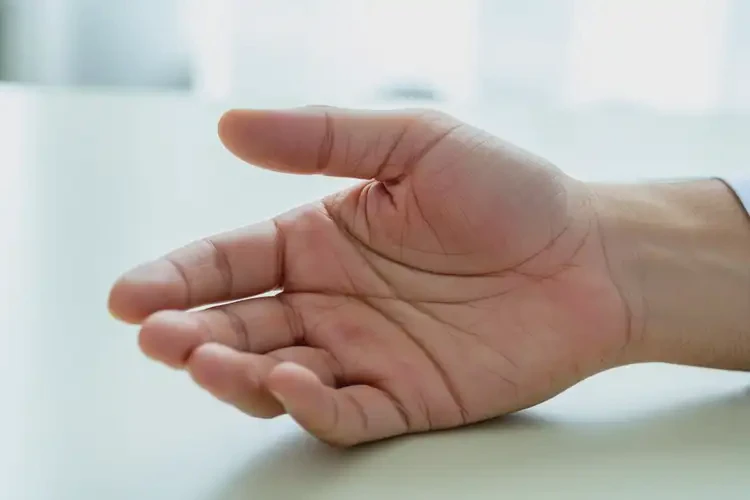 男人手上起濕疹可以徹底自愈嗎(圖4)