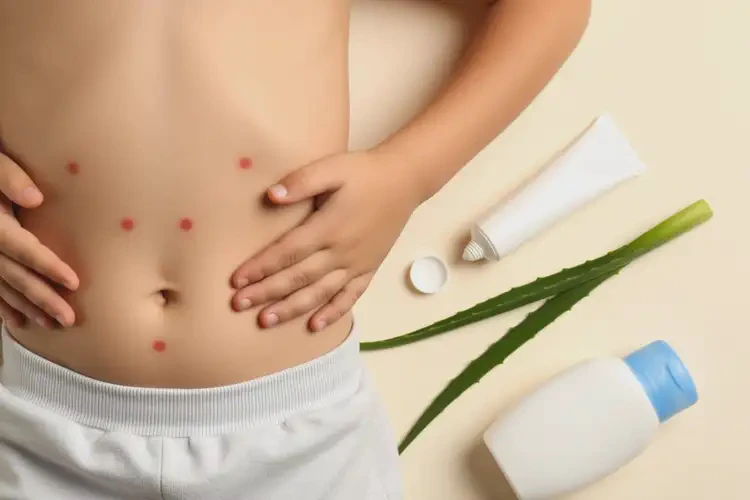 孩子肚子出濕疹不管它會自己自愈嗎(圖2)