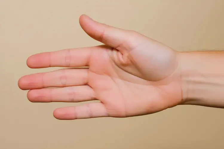 孕婦手上出濕疹不管它會自己自愈嗎(圖4)