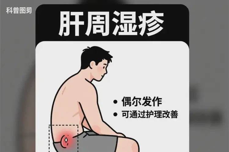 男生肛周偶爾起濕疹可不可以徹底自愈(圖1)