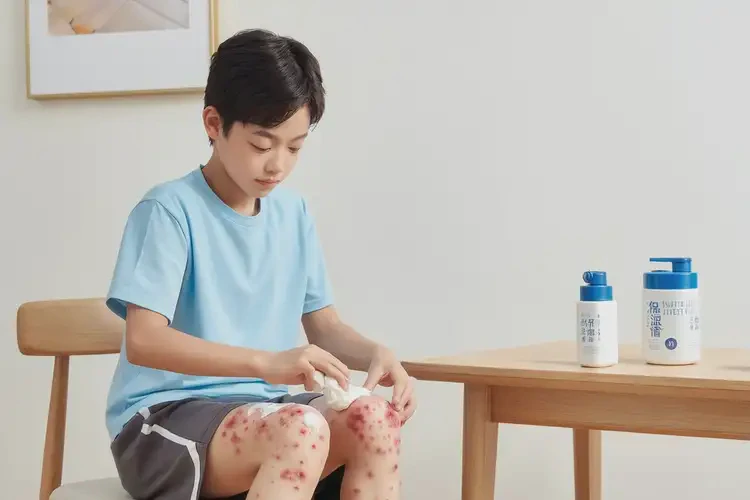 青少年大腿上经常起湿疹能彻底自愈吗(图2)