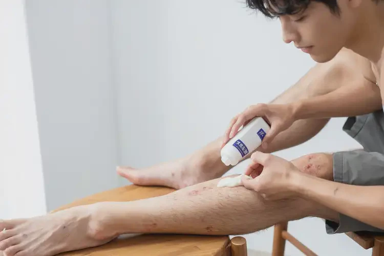 青年人小腿上容易起濕疹能不能徹底自愈(圖2)