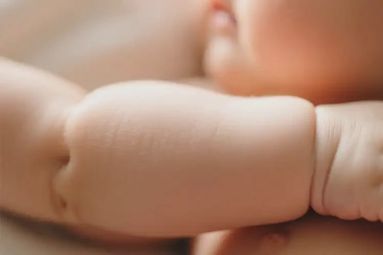 寶寶手臂上容易起濕疹能夠徹底治愈嗎(圖4)