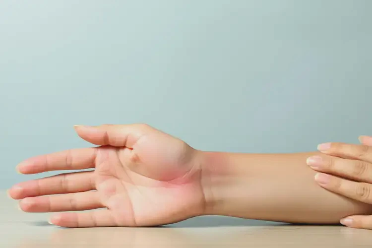 女性手臂上起濕疹不管它會(huì)自己自愈嗎(圖2)