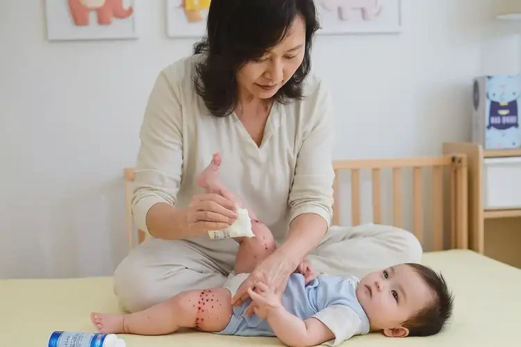 嬰兒大腿上長濕疹不管它會自己痊愈嗎(圖3)