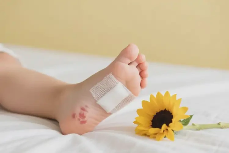 幼兒腳上容易起濕疹可以徹底自愈嗎(圖1)