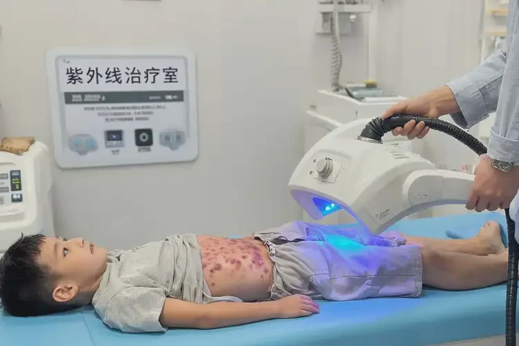 少兒肚子上出濕疹不管它會(huì)自己好嗎(圖1)