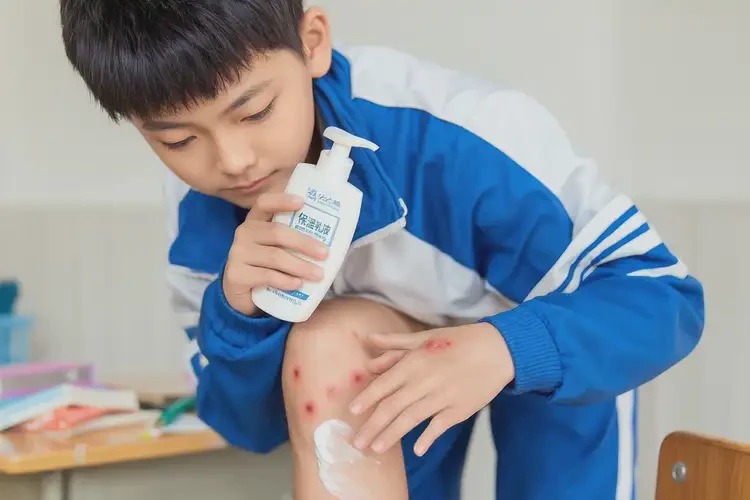 中學(xué)生小腿經(jīng)常長(zhǎng)濕疹不管它會(huì)自己自愈嗎(圖2)