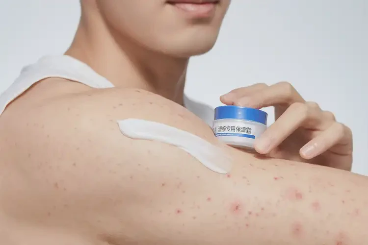 青年人手臂上容易長(zhǎng)濕疹不管它會(huì)自己自愈嗎(圖3)