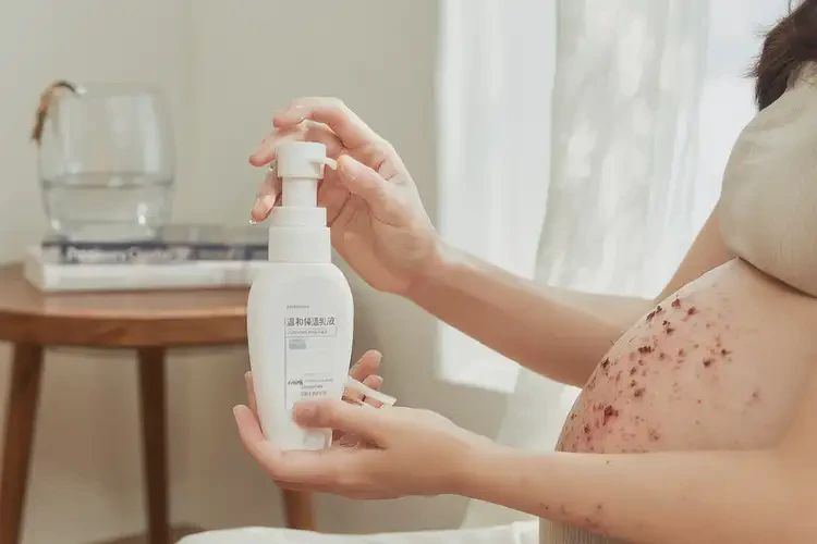 孕婦身上出現(xiàn)濕疹可不可以徹底自愈(圖3)