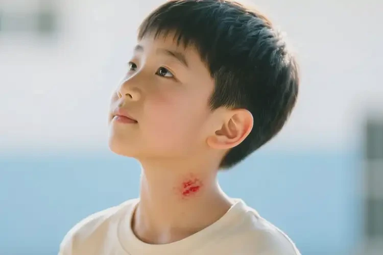 中學(xué)生脖子容易長濕疹能徹底自愈嗎(圖4)