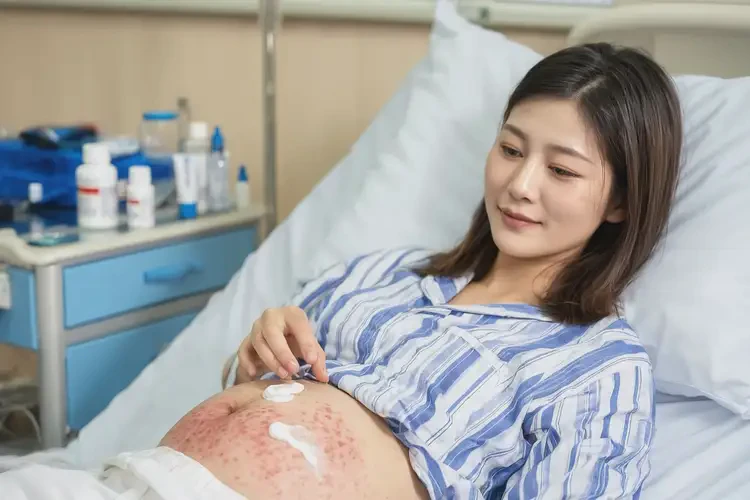 產(chǎn)婦肚子上有濕疹可不可以徹底自愈(圖3)