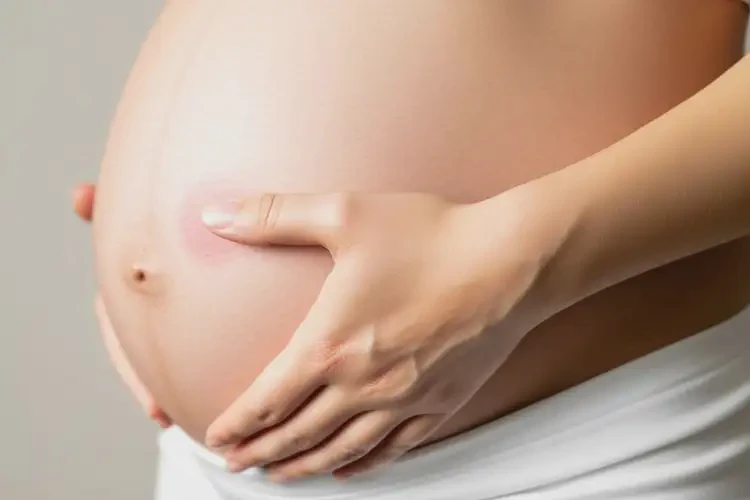 孕婦身上出濕疹可不可以徹底自愈(圖4)