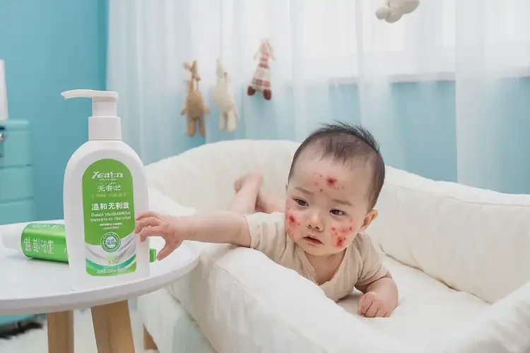 嬰兒四肢長濕疹不管它會自己自愈嗎(圖3)