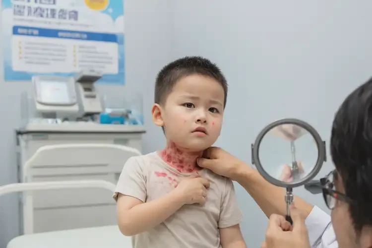 兒童脖子上偶爾長濕疹能夠徹底治愈嗎(圖4)