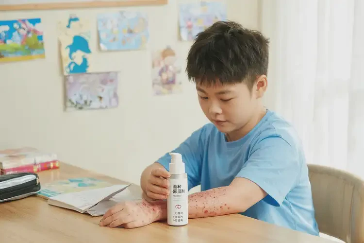 小學(xué)生四肢偶爾長濕疹可不可以徹底自愈(圖2)