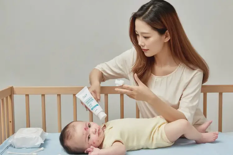 嬰兒脖子有濕疹可以徹底自愈嗎(圖3)