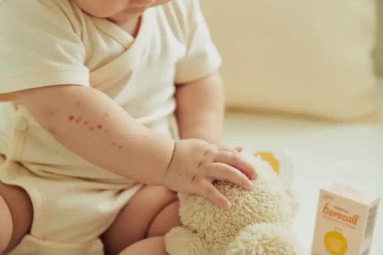 嬰幼兒四肢偶爾長濕疹能夠徹底治愈嗎(圖3)