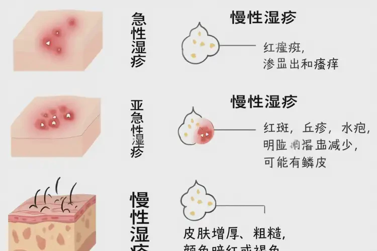 小學生脖子上偶爾起濕疹不管它會自己自愈嗎(圖1)