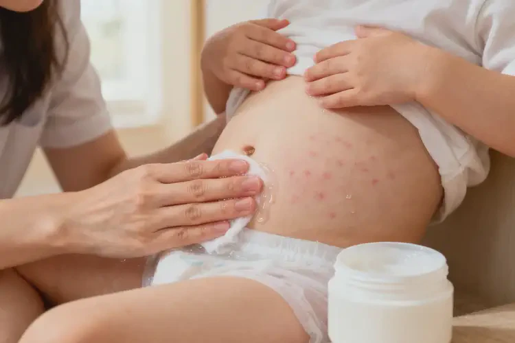 兒童肚子上偶爾長濕疹不管它會自己痊愈嗎(圖3)