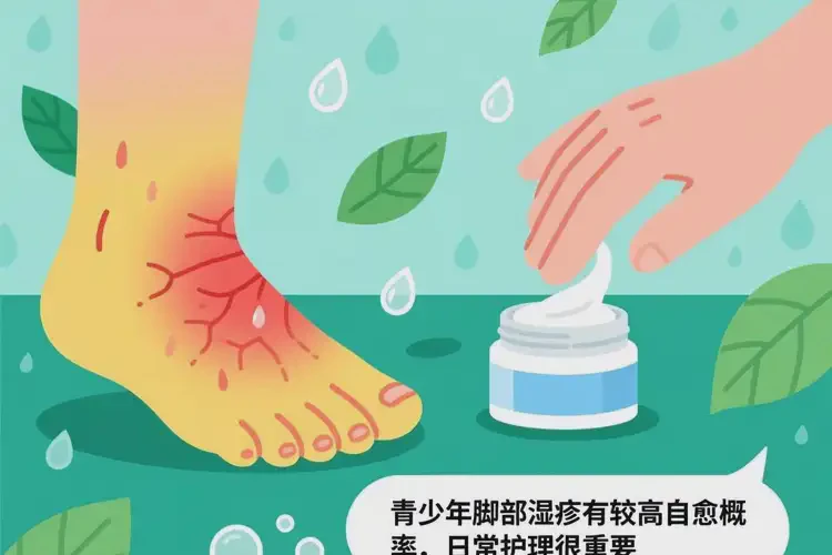 青少年腳上容易起濕疹不管它會自己好嗎(圖3)
