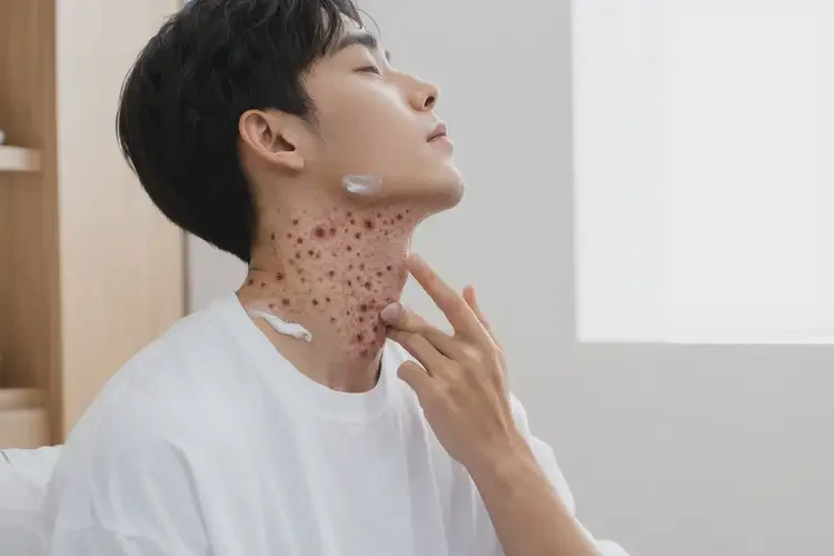 青年人脖子經(jīng)常起濕疹不管它會自己好嗎(圖2)