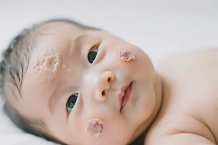 寶寶臉上長濕疹不管它會自己自愈嗎(圖3)