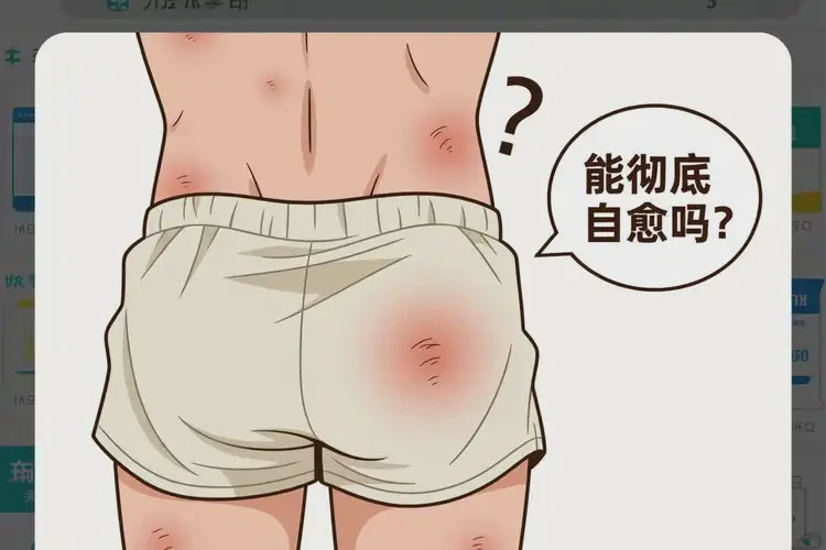 青年人屁股出現(xiàn)濕疹能徹底自愈嗎(圖2)