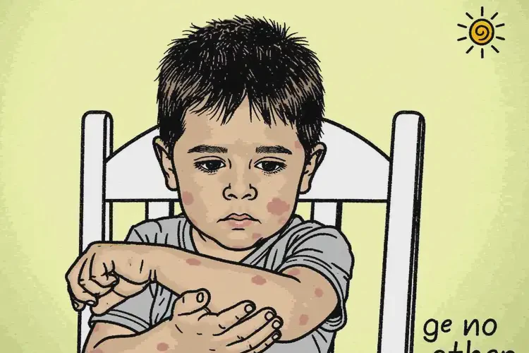 少兒手臂上長(zhǎng)濕疹可不可以徹底自愈(圖2)