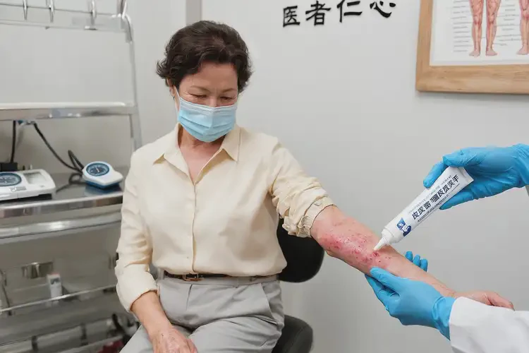 女性四肢经常长湿疹能靠自己自愈吗(图3)